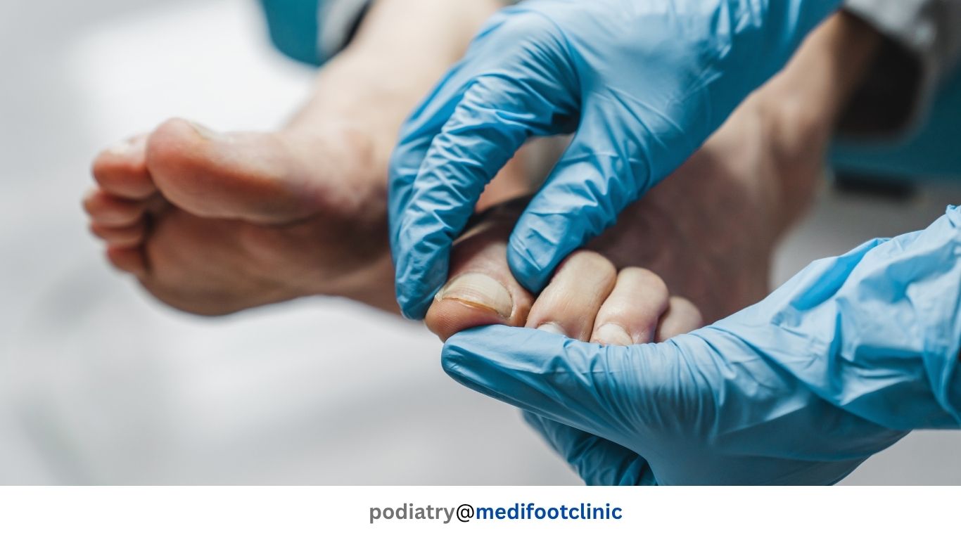 Supportive footwear for diabetes