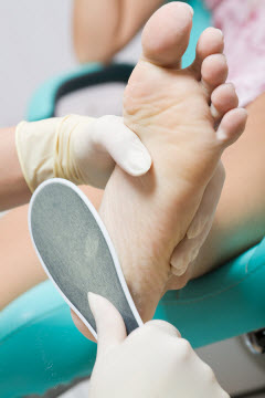 Corns And Callus Treatment